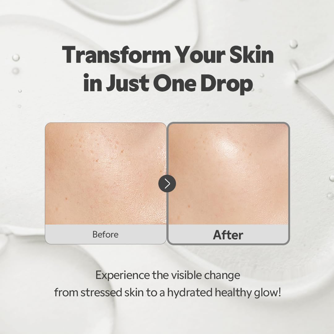 TIRTIR SOS SERUM