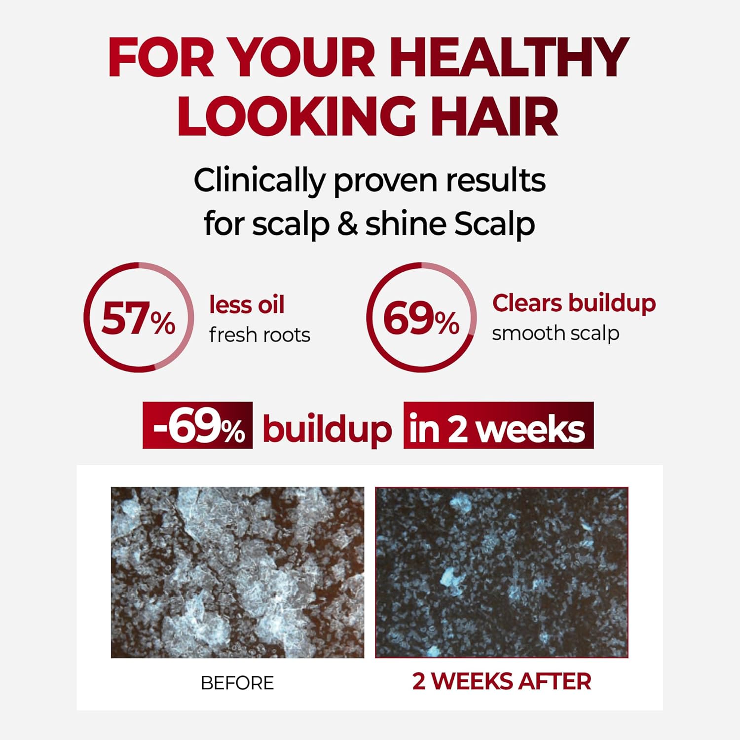 KUNDAL CAFFEINE SCALP SHAMPOO CHERRY BLOSSOM 500ML